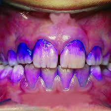 Curaprox Plaquefinder PCA 223, litatöflur